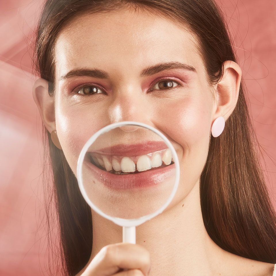 avaliação virtual aparelho invisível SouSmile